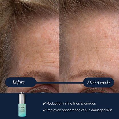 ELEMIS Pro-Collagen Renewal Serum 15ml - Gentle Retinol Alternative for Smoothing Fine Lines & Wrinkles Avelisse
