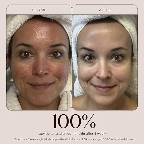 True Botanicals Chebula Active Serum – Anti-Aging Face Serum for Fine Lines & Wrinkles, Natural & Vegan Avelisse
