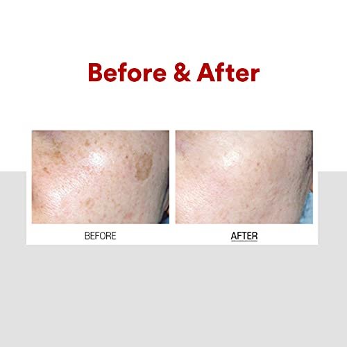 Medi-Peel Melanon X Cream 1.01 oz - Dark Spot Corrector & Brightening Moisturizer for Face, Anti-Aging Korean Skincare Avelisse