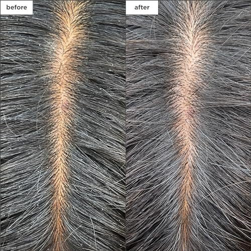 Briogeo Scalp Revival Charcoal + Tea Tree Cooling Hydration Scalp Mask - Weekly Detoxifying & Moisturizing Scalp Treatment for Dry, Flaky, or Itchy Scalp - Vegan & Cruelty Free - 6 oz Avelisse