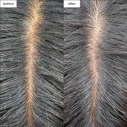 Briogeo Scalp Revival Charcoal + Tea Tree Cooling Hydration Scalp Mask - Weekly Detoxifying & Moisturizing Scalp Treatment for Dry, Flaky, or Itchy Scalp - Vegan & Cruelty Free - 6 oz Avelisse