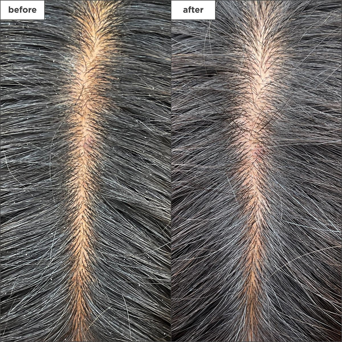 Briogeo Scalp Revival Charcoal + Tea Tree Cooling Hydration Scalp Mask - Weekly Detoxifying & Moisturizing Scalp Treatment for Dry, Flaky, or Itchy Scalp - Vegan & Cruelty Free - 6 oz Avelisse