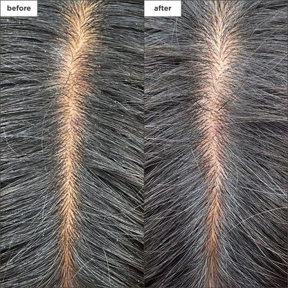 Briogeo Scalp Revival Charcoal + Tea Tree Cooling Hydration Scalp Mask - Weekly Detoxifying & Moisturizing Scalp Treatment for Dry, Flaky, or Itchy Scalp - Vegan & Cruelty Free - 6 oz Avelisse