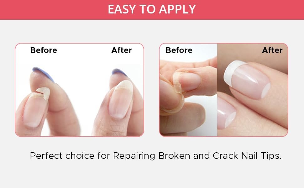 Professional Nail Repair Kit for Broken, Cracked, Split & Weak Nails – Easy Quick Fix Solution Avelisse