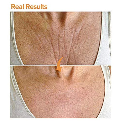 PAPABA 2-Pack Chest Wrinkle Pads – Reusable Silicone Sleep Patches for Décolleté & Chest Anti-Aging, Medical Grade Skin Care