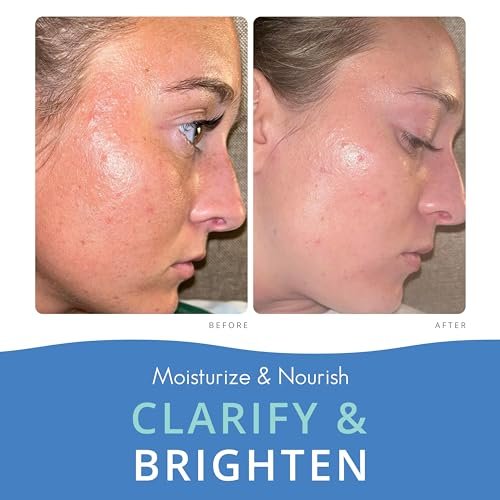Almond Clear 2-in-1 Hydrating Gel | Lightweight Mandelic Acid Moisturizer for Oily, Blemish-Prone Skin | Aloe Vera, Squalane, Hyaluronic Acid, Bakuchiol | 4 oz Avelisse