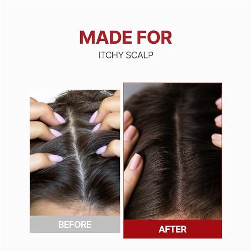 Kundal Caffeine Hair Loss Scalp Tonic - Soothes Scalp, Stimulates Hair Follicles with Vitamin B3, Tea Tree & Peppermint Oil, Korean Hair Care, 3.38 Fl Oz Avelisse