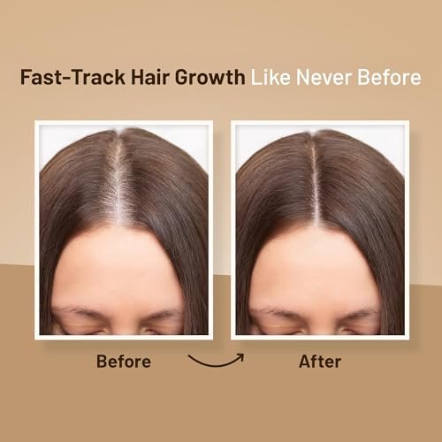 Herbishh Thickening Shampoo and Conditioner Set with Hair Vitalizer & Growth Essence Oil - 4-in-1 Hair Care System for Thinning Hair, Prevents Hair Loss, Supports Healthy Growth - görsel 6