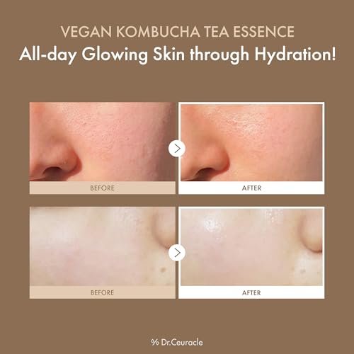 Dr.Ceuracle Vegan Kombucha Tea Essence – Hydrating Milky Toner with Kombucha Tea Extract, Centella Asiatica & Ceramide, Korean Skincare Essence (150 ml / 5.07 fl. oz.) - görsel 5