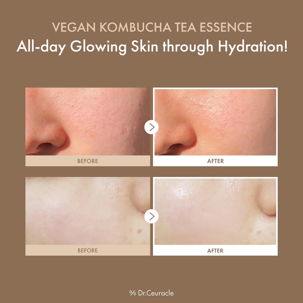 Dr.Ceuracle Vegan Kombucha Tea Essence – Hydrating Milky Toner with Kombucha Tea Extract, Centella Asiatica & Ceramide, Korean Skincare Essence (150 ml / 5.07 fl. oz.) - görsel 6