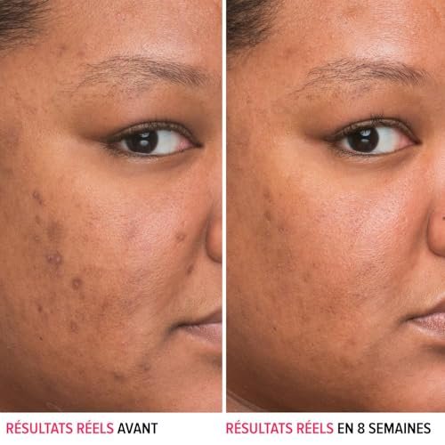 IT Cosmetics Bye Bye Dark Spots 4% Niacinamide Serum – Visibly Reduces Dark Spots & Improves Skin Clarity in 8 Weeks – Facial Serum with 1% Ethyl Vitamin C – For All Skin Types – 1 Fl. Oz - görsel 4