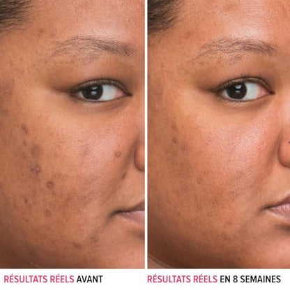 IT Cosmetics Bye Bye Dark Spots 4% Niacinamide Serum – Visibly Reduces Dark Spots & Improves Skin Clarity in 8 Weeks – Facial Serum with 1% Ethyl Vitamin C – For All Skin Types – 1 Fl. Oz