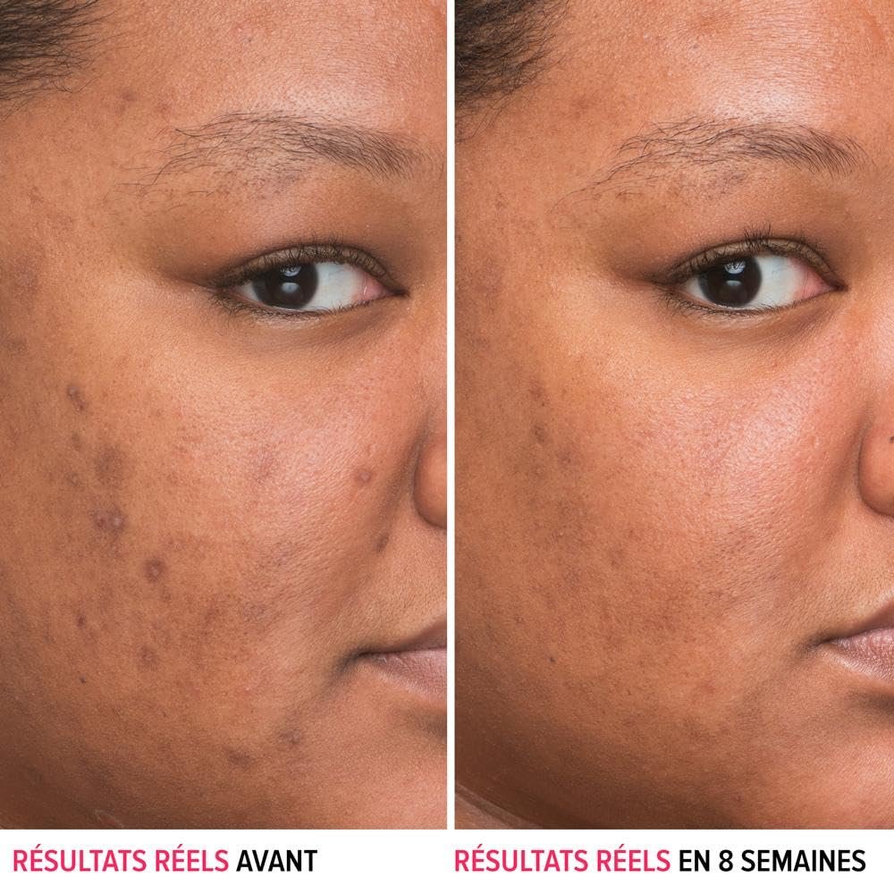 IT Cosmetics Bye Bye Dark Spots 4% Niacinamide Serum – Visibly Reduces Dark Spots & Improves Skin Clarity in 8 Weeks – Facial Serum with 1% Ethyl Vitamin C – For All Skin Types – 1 Fl. Oz - görsel 3