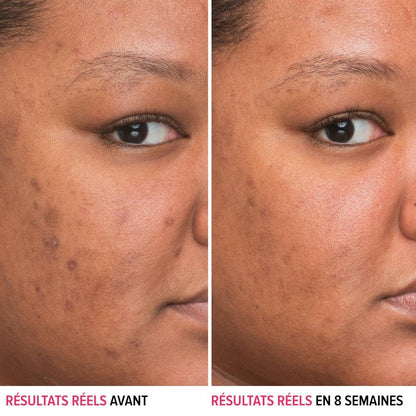IT Cosmetics Bye Bye Dark Spots 4% Niacinamide Serum – Visibly Reduces Dark Spots & Improves Skin Clarity in 8 Weeks – Facial Serum with 1% Ethyl Vitamin C – For All Skin Types – 1 Fl. Oz