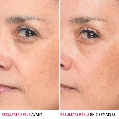 IT Cosmetics Bye Bye Lines Hyaluronic Acid Serum – Anti-Aging Hydrating Facial Serum with Peptide & Vitamin B5, Visibly Plumps and Smooths Fine Lines, For All Skin Types, 1 fl oz - görsel 4