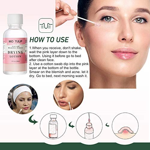 MO TULIP Acne Drying Lotion - Overnight Acne Spot Treatment with Salicylic Acid for Face and Body, 1 oz - görsel 12
