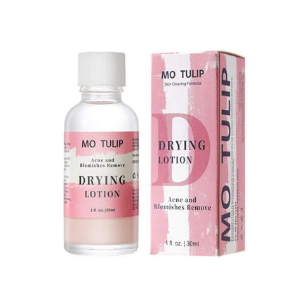 MO TULIP Acne Drying Lotion - Overnight Acne Spot Treatment with Salicylic Acid for Face and Body, 1 oz