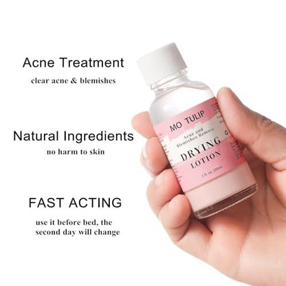 MO TULIP Acne Drying Lotion - Overnight Acne Spot Treatment with Salicylic Acid for Face and Body, 1 oz