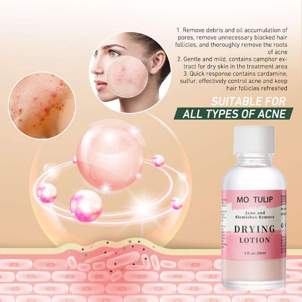 MO TULIP Acne Drying Lotion - Overnight Acne Spot Treatment with Salicylic Acid for Face and Body, 1 oz - görsel 9