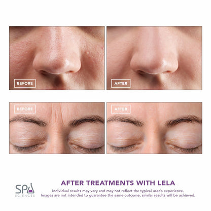 Spa Sciences LELA 4-in-1 Facial Spatula for Deep Cleansing, Pore Extraction, Serum Infusion, Anti-Aging & Contouring - Pink Avelisse