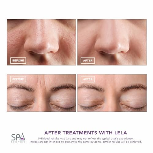Spa Sciences LELA 4-in-1 Facial Spatula for Deep Cleansing, Pore Extraction, Serum Infusion, Anti-Aging & Contouring - Pink Avelisse