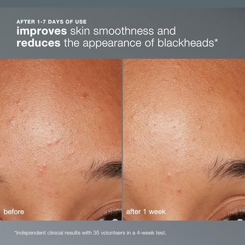Dermalogica Daily Microfoliant - Gentle Rice-Based Exfoliator with Salicylic Acid & Papaya Enzyme for Brighter, Smoother Skin (2.6 oz Refill) Avelisse