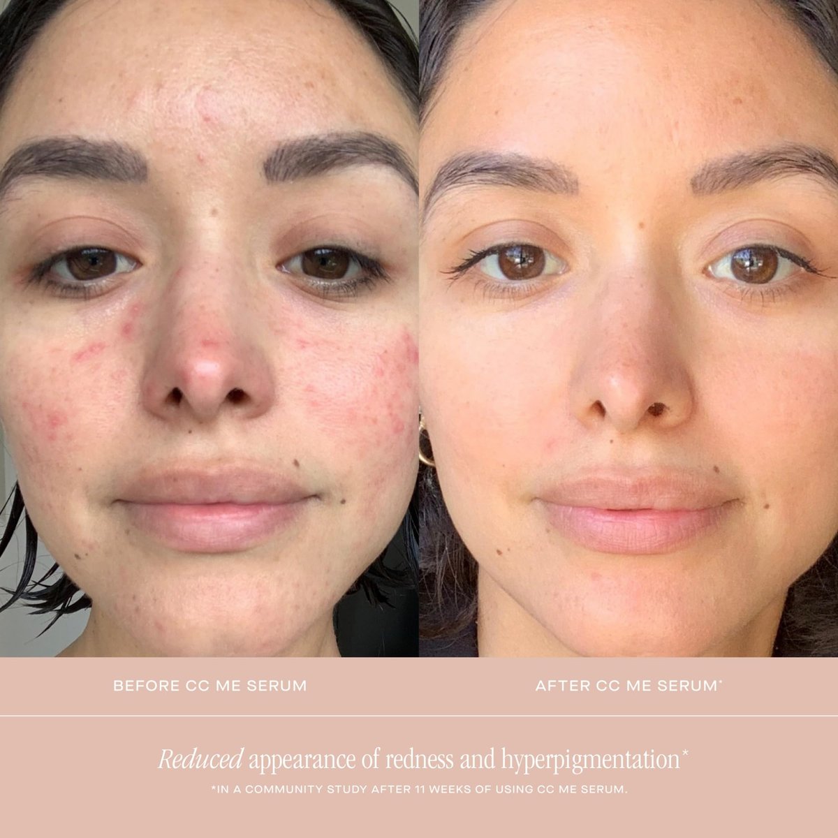 Summer Fridays CC Me Serum with Vitamin C + Niacinamide - Brightening & Hydrating Face Serum, 1 Fl Oz Avelisse