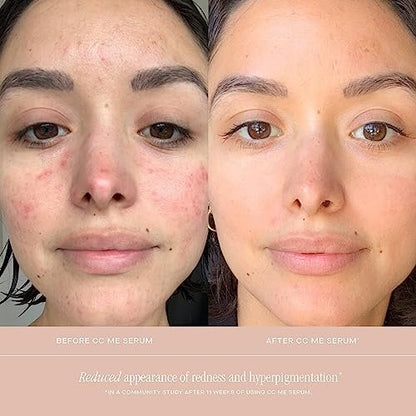 Summer Fridays CC Me Serum with Vitamin C + Niacinamide - Brightening & Hydrating Face Serum, 1 Fl Oz Avelisse