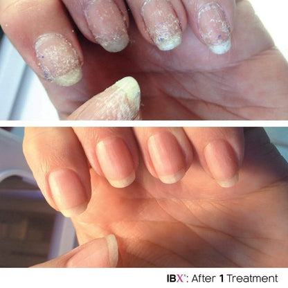 IBX Mini Duo Pack with FREE Dadi Oil – Restore & Protect Nails | Famous Names Avelisse