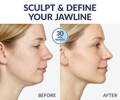 Stylia V Line Lifting Collagen Mask - Lift, Firm & Contour Jawline - Tightening Double Chin Strap with Hyaluronic Acid & Aloe - Neck Tightening and Lifting Mask (5 Pack) Avelisse