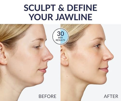 Stylia V Line Lifting Collagen Mask - Lift, Firm & Contour Jawline - Tightening Double Chin Strap with Hyaluronic Acid & Aloe - Neck Tightening and Lifting Mask (5 Pack) Avelisse