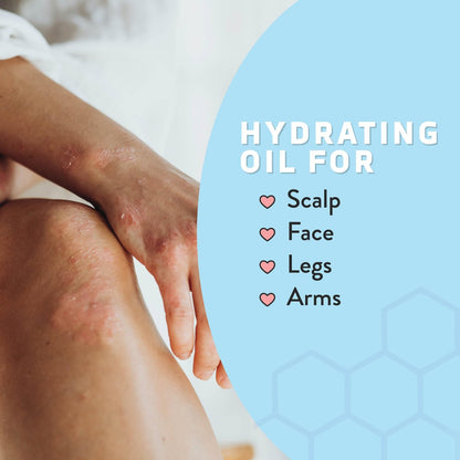 Psoriasis Honey Nourishing Scalp & Skin Serum - Dry Oil for Skin - Full Body Non Comedogenic Moisturizer Daily Dry Scalp Oil - Helps Psoriasis, Eczema, & More (1 Oz) Avelisse
