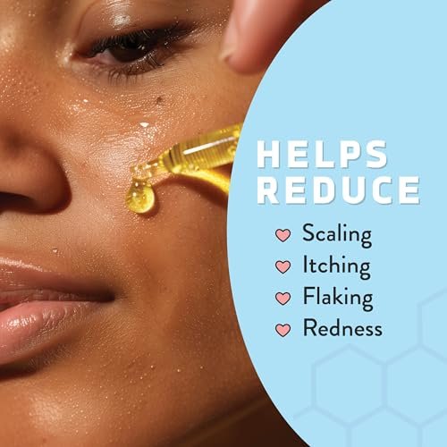 Psoriasis Honey Nourishing Scalp & Skin Serum - Dry Oil for Skin - Full Body Non Comedogenic Moisturizer Daily Dry Scalp Oil - Helps Psoriasis, Eczema, & More (1 Oz) Avelisse