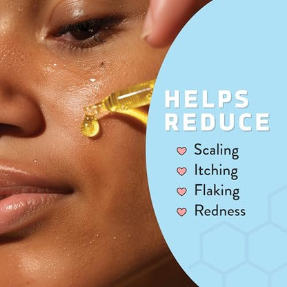 Psoriasis Honey Nourishing Scalp & Skin Serum - Dry Oil for Skin - Full Body Non Comedogenic Moisturizer Daily Dry Scalp Oil - Helps Psoriasis, Eczema, & More (1 Oz) Avelisse