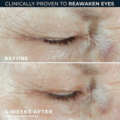 RoC Multi Correxion Hyaluronic Acid Anti Aging Under Eye Cream for Puffiness & Dark Circles + RoC Retinol Capsules (7 CT) – Fragrance & Paraben Free for Women and Men Avelisse
