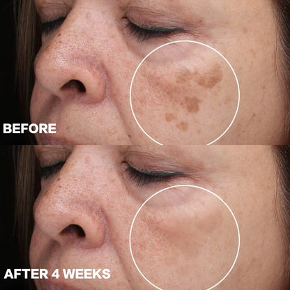 CITYGOO Dark Spot Remover for Face - Dark Spot Corrector Cream for Melasma, Freckles, Sun Spots & Blemishes - Enriching Skincare for All Skin Tones - 1.7 FL OZ Avelisse