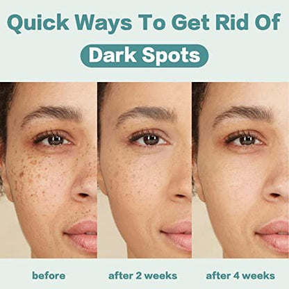 CITYGOO Dark Spot Remover for Face - Dark Spot Corrector Cream for Melasma, Freckles, Sun Spots & Blemishes - Enriching Skincare for All Skin Tones - 1.7 FL OZ Avelisse