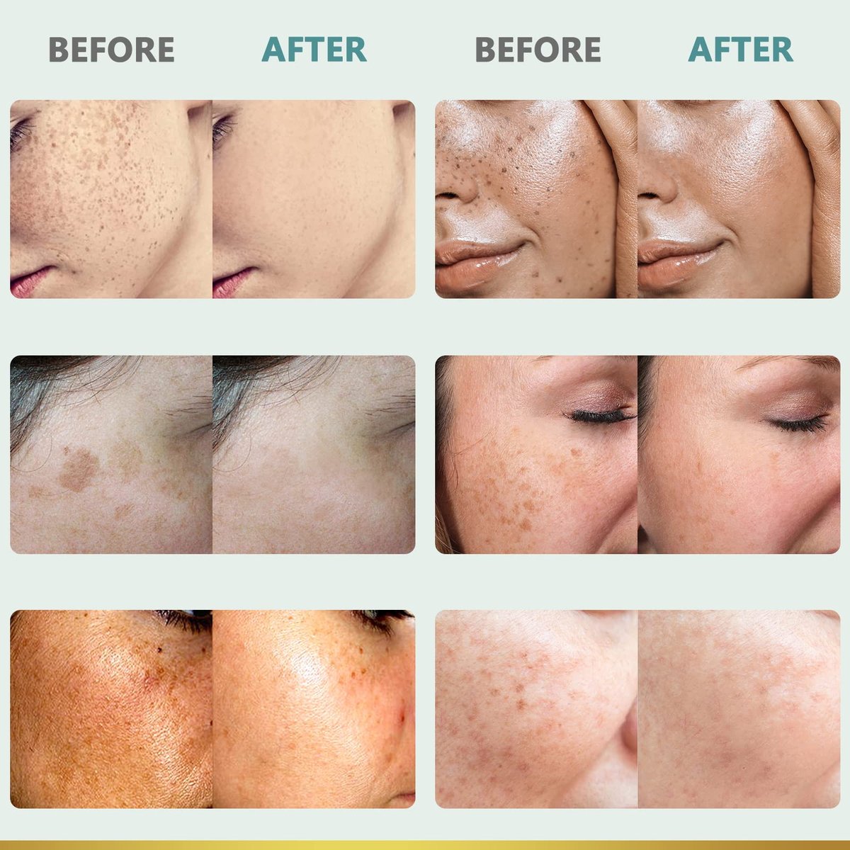 CITYGOO Dark Spot Remover for Face - Dark Spot Corrector Cream for Melasma, Freckles, Sun Spots & Blemishes - Enriching Skincare for All Skin Tones - 1.7 FL OZ Avelisse
