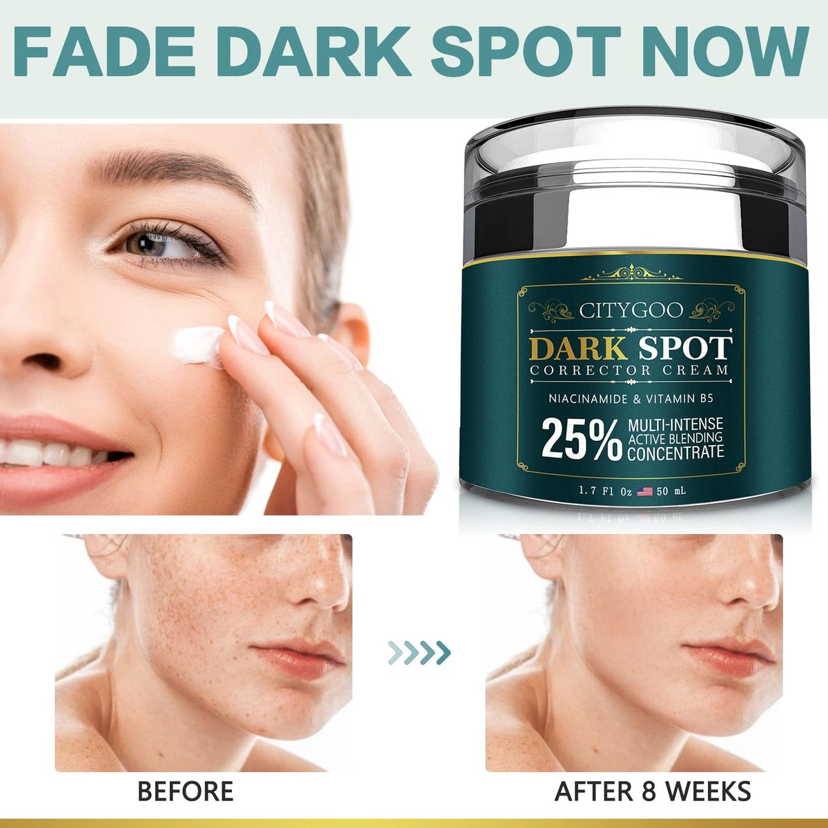 CITYGOO Dark Spot Remover for Face - Dark Spot Corrector Cream for Melasma, Freckles, Sun Spots & Blemishes - Enriching Skincare for All Skin Tones - 1.7 FL OZ Avelisse