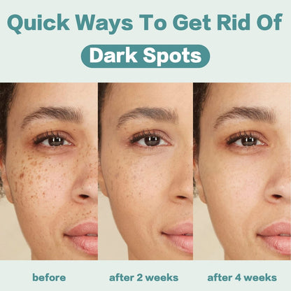 CITYGOO Dark Spot Remover for Face - Dark Spot Corrector Cream for Melasma, Freckles, Sun Spots & Blemishes - Enriching Skincare for All Skin Tones - 1.7 FL OZ Avelisse