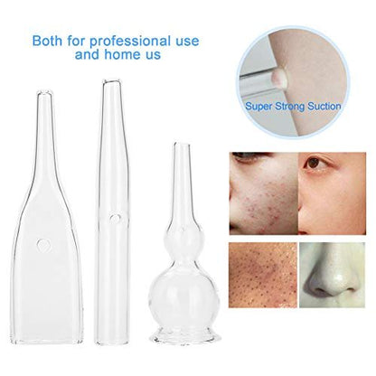 3pcs Vacuum Glass Tube Kit - Blackhead Removal Facial Suction Pore Vacuum Cleaner for Face, Microdermabrasion Machine Accessories Avelisse