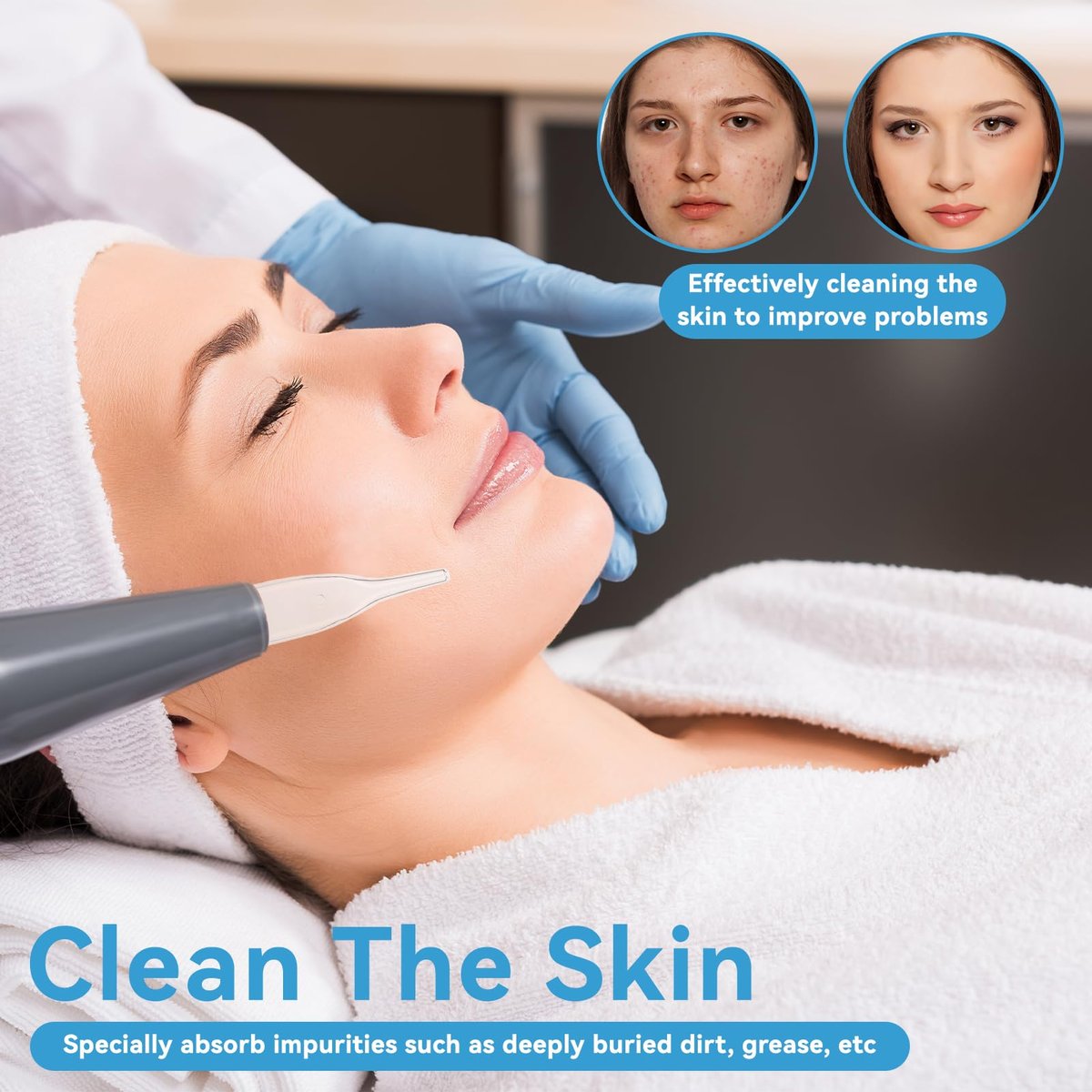 3pcs Vacuum Glass Tube Kit - Blackhead Removal Facial Suction Pore Vacuum Cleaner for Face, Microdermabrasion Machine Accessories Avelisse