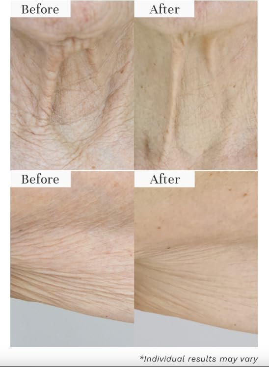City Beauty InvisiCrepe Body Balm - Skin Firming & Tightening Lotion for a Smoother, Firmer Look | Anti-Aging Firming Body Cream Avelisse