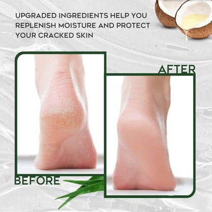 Vebuni Urea Cream 42% + Salicylic Acid - Intensive Callus Remover for Feet, Knees & Elbows, 4 oz - Moisturizes & Softens Dry, Rough Skin