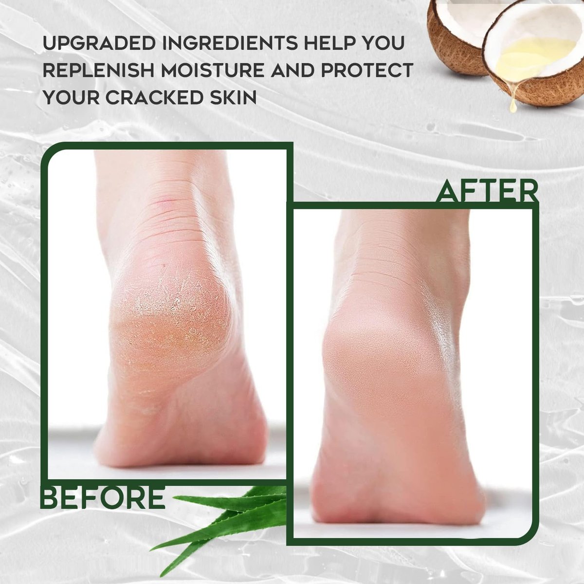 Vebuni Urea Cream 42% + Salicylic Acid - Intensive Callus Remover for Feet, Knees & Elbows, 4 oz - Moisturizes & Softens Dry, Rough Skin - görsel 9