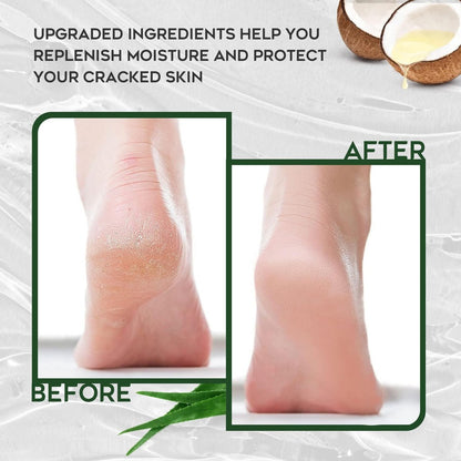 Vebuni Urea Cream 42% + Salicylic Acid - Intensive Callus Remover for Feet, Knees & Elbows, 4 oz - Moisturizes & Softens Dry, Rough Skin