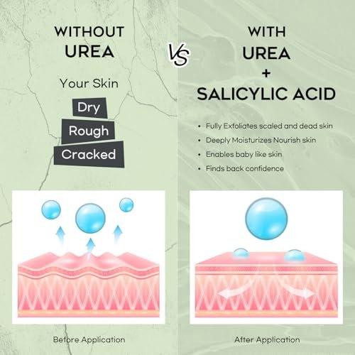Vebuni Urea Cream 42% + Salicylic Acid - Intensive Callus Remover for Feet, Knees & Elbows, 4 oz - Moisturizes & Softens Dry, Rough Skin - görsel 12