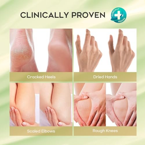 Vebuni Urea Cream 42% + Salicylic Acid - Intensive Callus Remover for Feet, Knees & Elbows, 4 oz - Moisturizes & Softens Dry, Rough Skin - görsel 8
