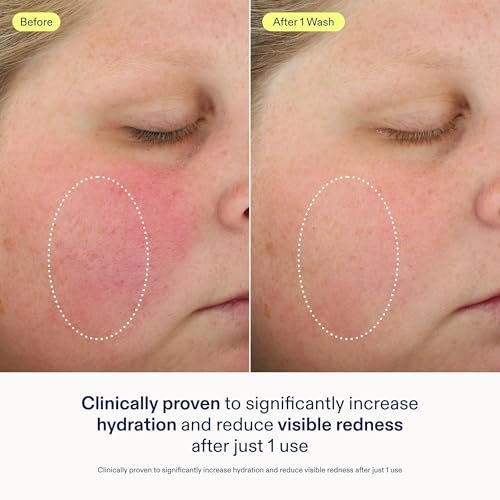Skinfix Foaming Oil Cleanser for Face – 6 oz – Hydrating Gel-to-Foam Formula for Dry, Sensitive Skin – Fragrance Free, Vegan, Cruelty Free Avelisse