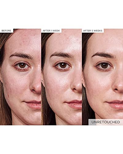 Glow Recipe Avocado Ceramide Serum – Soothing, Hydrating Face Serum for Redness Relief & Skin Barrier Repair, Lightweight Milky Korean Skincare for Dry & Sensitive Skin (30 ml) Avelisse